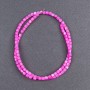 Toned freshwater pearls beads Malachite pink cylinder? Wait not. Please fix.